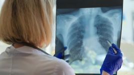 Apsces pluća: Uzroci, simptomi i lečenje