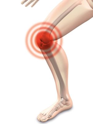 MR dijagnostika kolena