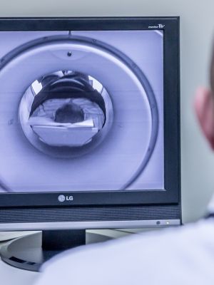 Magnetna rezonanca stomaka