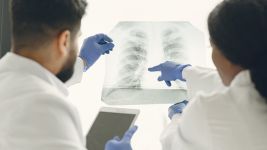 Edem pluća: Uzroci, simptomi i lečenje