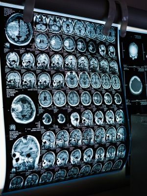 MR dijagnostika glave