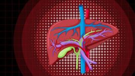 Adenom jetre: Uzroci i simptomi