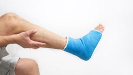 Uzroci i simptomi preloma stopala